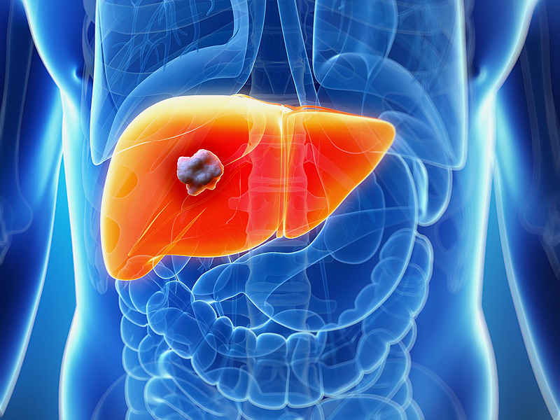 New treatment of liver cancer
