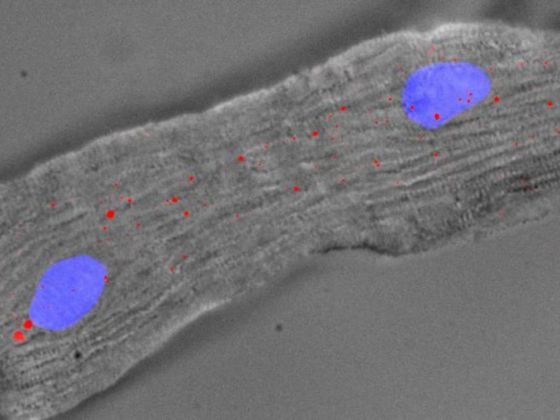 A mouse heart cell with 2 nuclei (blue) and Singheart RNA labelled by red fluorescent  dyes.