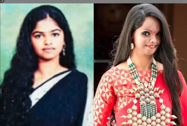 Deepika as Malti is a taller version of Laxmi, who became a campaigner for the rights of acid attack victims as well as a TV host. Photo Courtesy: Twitter