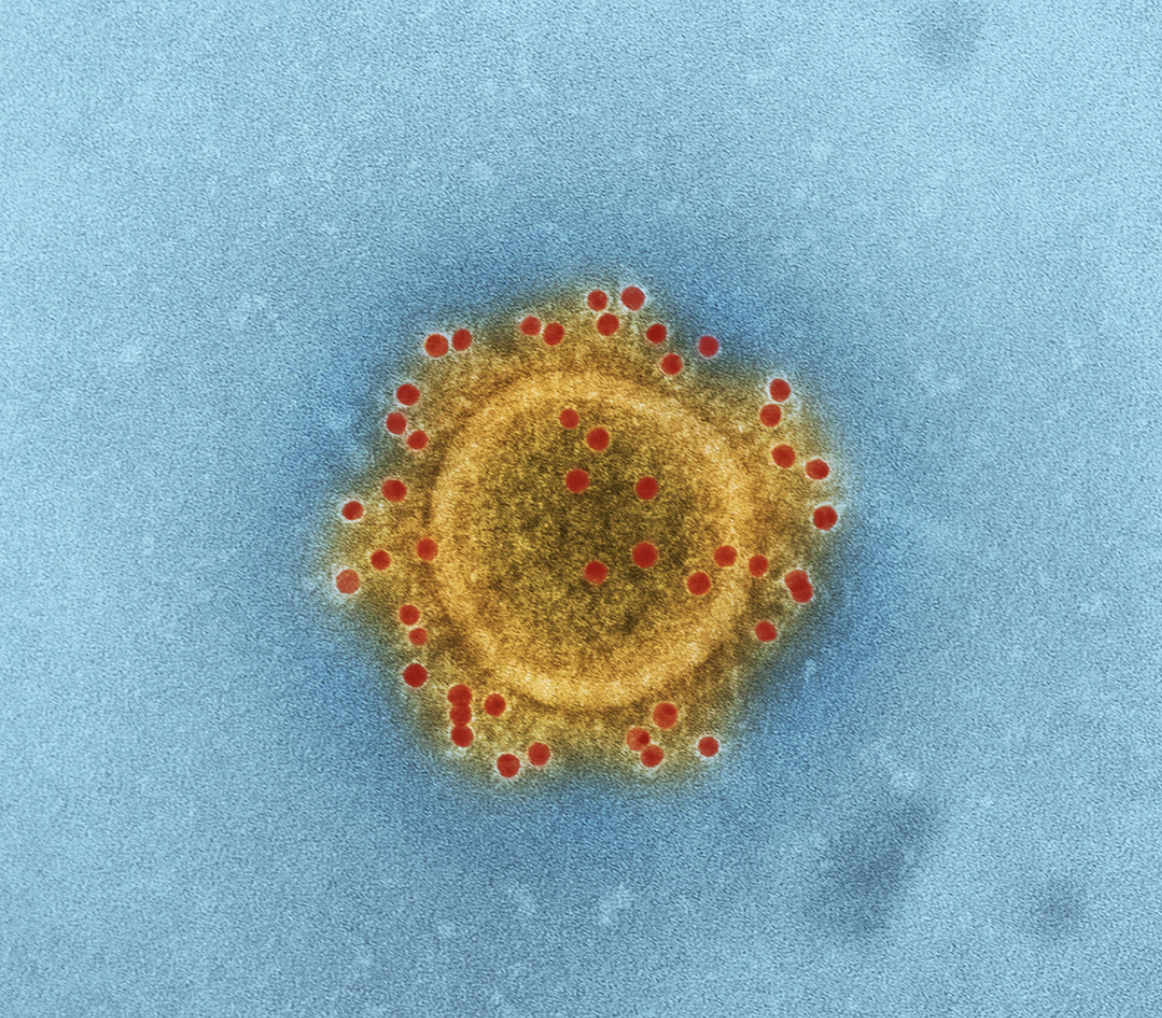 As of 12pm on January 27 in Singapore, 62 of the suspect Wuhan coronavirus cases have tested negative for the Wuhan coronavirus. Five have tested positive. Photo courtesy: unsplash