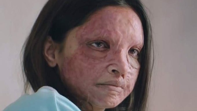 Calls for a boycott fail to affect Chhapaak’s international revenue collection