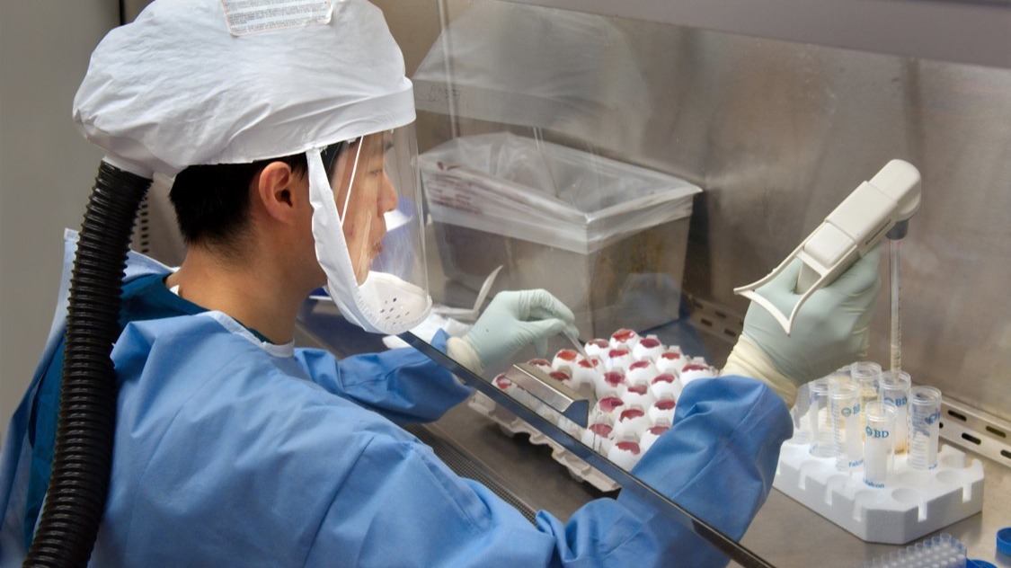 33 cases identified as COVID-19 found to be false positives, says Ministry of Health