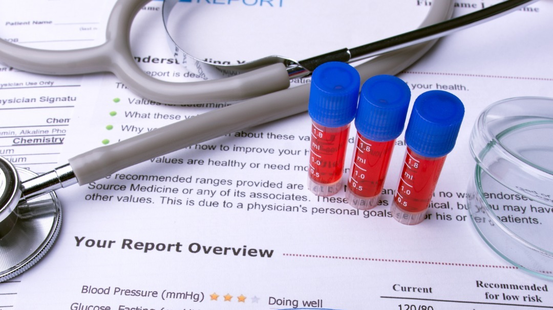 Things to know before you get a lab test in Bangalore