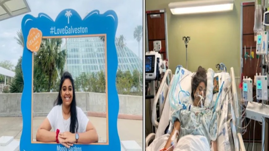 NRI graduate student in US in critical condition after being struck by lightning