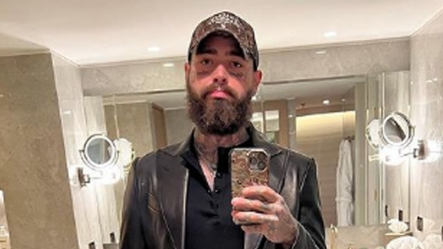 Musician Post Malone impresses fans with his weight loss journey