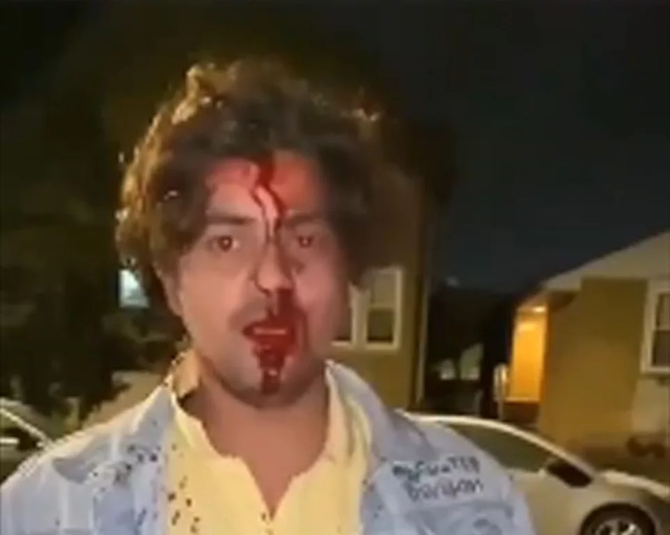 US: Indian-origin student injured after he was attacked, robbed in Chicago