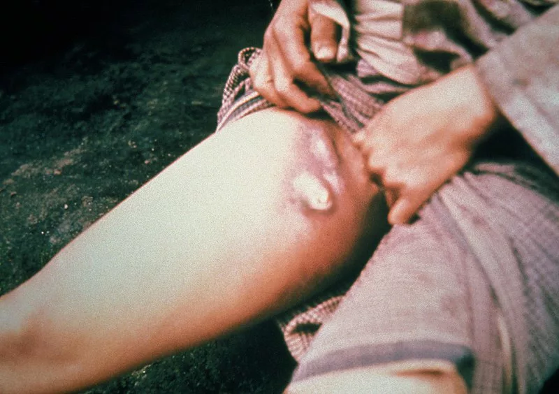 Deschutes County said the individual was likely infected by their symptomatic pet cat.