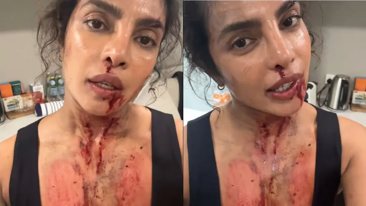 WATCH: Priyanka Chopra shares ‘really glamorous’ video of herself covered in blood and scars from sets of The Bluff