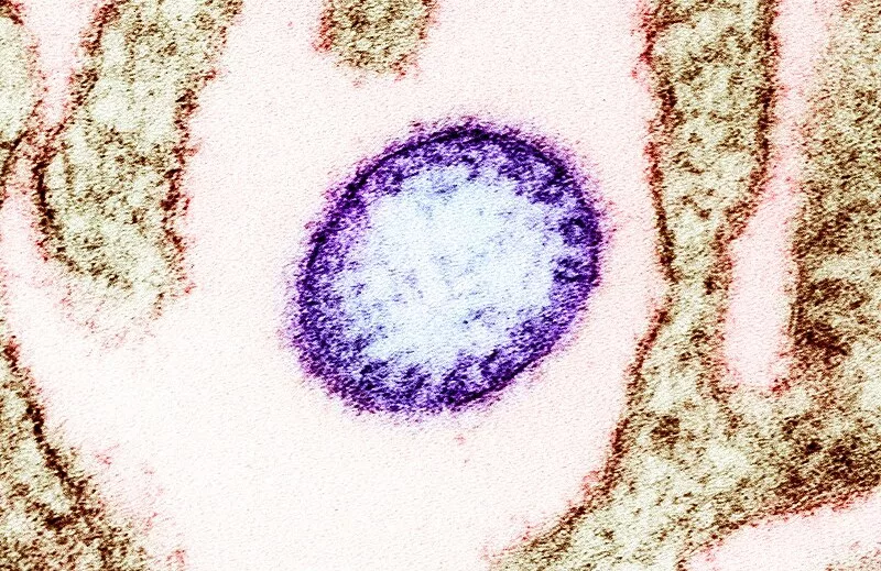 Nipah virus-infected Indian teen dies in Kerala