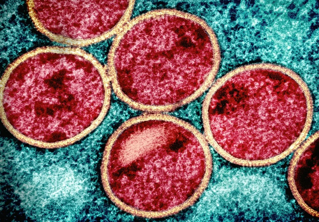 Singapore likely to see mpox cases due to global connectivity, says Health Minister Ong Ye Kung