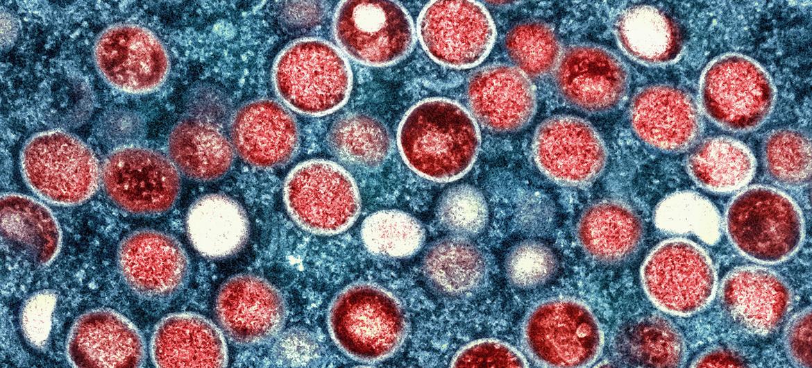 Mpox scare: UNICEF issues USD 58.8 million appeal to halt outbreak in Africa