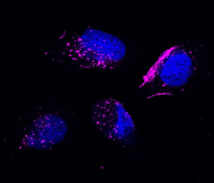 Singapore: NCCS scientists successfully target TKI-resistant cancer using exosomes from living cells