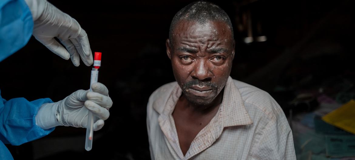 WHO approves first mpox vaccine amid risiing cases in Africa