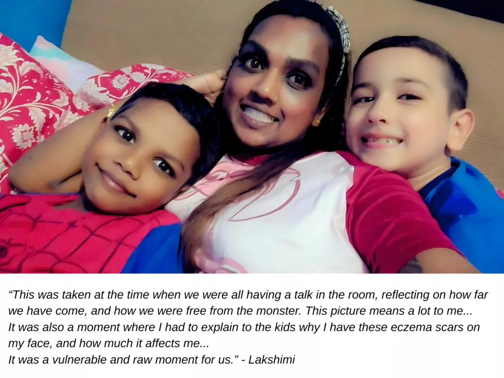 Ray of Hope fundraiser beneficiary Lakshimi